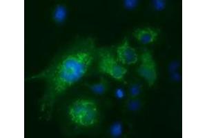 Anti-FAHD2A mouse monoclonal antibody (ABIN2453023) immunofluorescent staining of COS7 cells transiently transfected by pCMV6-ENTRY FAHD2A (RC211128). (FAHD2A Antikörper)