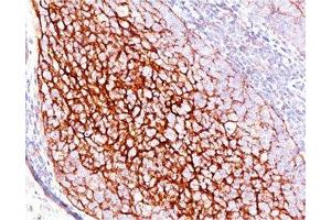 IHC testing of human tonsil stained with CD35 antibody (E11). (CD35 Antikörper)
