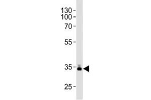 Western blot analysis of lysate from human plasma tissue lysate using ApoE antibody diluted at 1:1000. (APOE Antikörper  (AA 263-292))