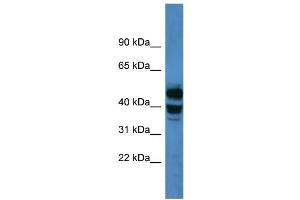 WB Suggested Anti-CYP21A2 Antibody Titration: 0. (CYP21A2 Antikörper  (C-Term))
