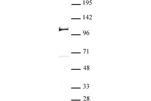 PHF20 antibody (pAb) tested by Western blot 20 μg nuclear extract of F9 retinoic acid -treated mouse teratocarcinoma stem cells probed with PHF20 antibody (1:500). (PHF20 Antikörper)