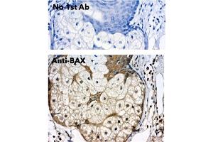 Immunohistochemistry (IHC) image for anti-BCL2-Associated X Protein (BAX) (N-Term) antibody (ABIN6254209)