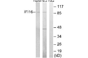 Western blot analysis of extracts from HeLa cells and HepG2 cells, using IFI16 antibody. (IFI16 Antikörper  (Internal Region))