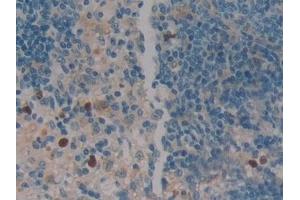 Immunohistochemistry (IHC) image for anti-serpin Peptidase Inhibitor, Clade B (Ovalbumin), Member 1 (SERPINB1) (AA 17-332) antibody (ABIN7443074)