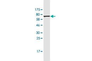 Western Blotting (WB) image for anti-Beta-secretase 1 (BACE1) (AA 22-501) antibody (ABIN2566113)