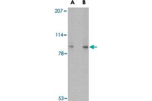 Western blot analysis of VPS53 in 293 cell lysate with VPS53 polyclonal antibody  at (A) 0. (VPS53 Antikörper  (C-Term))
