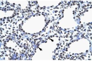 Human Lung; MYEF2 antibody - middle region in Human Lung cells using Immunohistochemistry (MYEF2 Antikörper  (Middle Region))