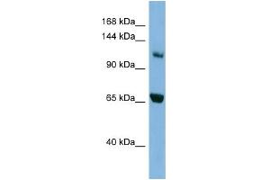 WB Suggested Anti-MYO1E Antibody Titration: 0. (MYO1E Antikörper  (Middle Region))