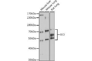 Western Blotting (WB) image for anti-Embryonic Ectoderm Development (EED) (AA 1-100) antibody (ABIN6139940)