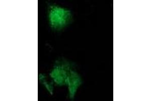 Anti-CAT mouse monoclonal antibody (ABIN2454281) immunofluorescent staining of COS7 cells transiently transfected by pCMV6-ENTRY CAT (RC210763). (Catalase Antikörper)