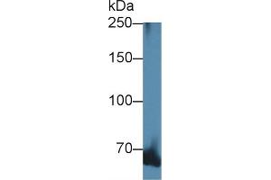Western Blotting (WB) image for anti-Adducin 1 (Alpha) (ADD1) (AA 388-560) antibody (ABIN7444757)