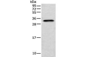Western blot analysis of Human testis tissue using LYPD4 Polyclonal Antibody at dilution of 1:400