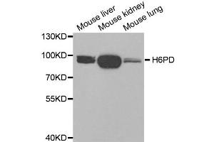 Western blot analysis of extracts of various tissues, using H6PD antibody. (Glucose-6-Phosphate Dehydrogenase Antikörper)