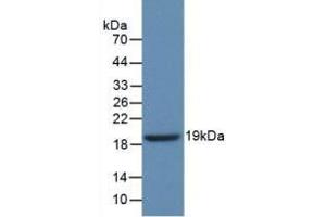 Western blot analysis of recombinant Human GbA. (GBA Antikörper  (AA 334-498))