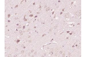 Immunohistochemistry (Paraffin-embedded Sections) (IHC (p)) image for anti-ATPase, Cu++ Transporting, alpha Polypeptide (ATP7A) (AA 242-285) antibody (ABIN731513)