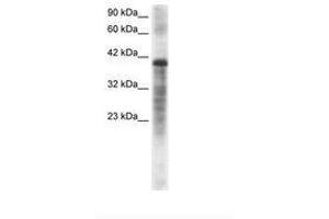 Image no. 2 for anti-Proteasome (Prosome, Macropain) 26S Subunit, ATPase, 3 (PSMC3) (AA 293-339) antibody (ABIN202439) (PSMC3 Antikörper  (AA 293-339))