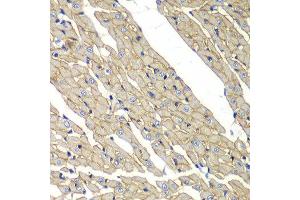 Immunohistochemistry of paraffin-embedded rat heart using SGCD antibody at dilution of 1:100 (x40 lens). (SGCD Antikörper)