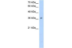 WB Suggested Anti-OTC Antibody Titration:  2. (OTC Antikörper  (N-Term))