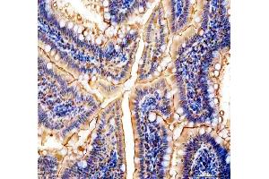 IHC analysis of NMU using anti-NMU antibody (ABIN5692905).