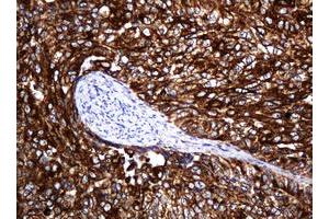 Image no. 7 for anti-Pogo Transposable Element with KRAB Domain (POGK) antibody (ABIN1500329)