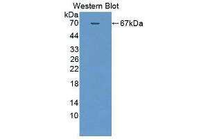 Western blot analysis of the recombinant protein. (SMPD2 Antikörper  (AA 1-324))
