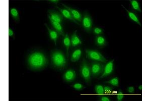 Immunofluorescence (IF) image for anti-Activating Transcription Factor 4 (Tax-Responsive Enhancer Element B67) (ATF4) (AA 171-270) antibody (ABIN559979)