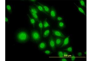 Immunofluorescence of monoclonal antibody to ATF4 on HeLa cell. (ATF4 Antikörper  (AA 171-270))