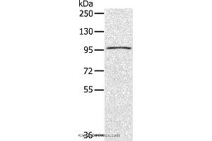 Western blot analysis of A549 cell, using CIZ1 Polyclonal Antibody at dilution of 1:200