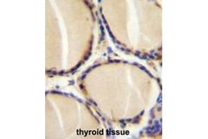 CALCA Antibody (Center) immunohistochemistry analysis in formalin fixed and paraffin embedded human thyroid tissue followed by peroxidase conjugation of the secondary antibody and DAB staining. (CGRP Antikörper  (Middle Region))