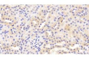 Immunohistochemistry (IHC) image for anti-Matrix Metallopeptidase 3 (Stromelysin 1, Progelatinase) (MMP3) (AA 100-477) antibody (ABIN7431002)