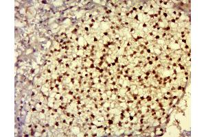 Western Blotting (WB) image for anti-DnaJ (Hsp40) Homolog, Subfamily C, Member 21 (DNAJC21) (AA 11-120) antibody (ABIN5001381)