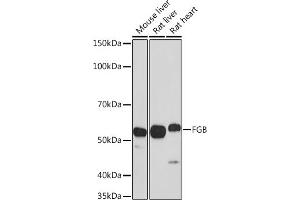 Western blot analysis of extracts of various cell lines, using FGB antibody (ABIN3021949, ABIN3021950, ABIN3021951 and ABIN6218213) at 1:1000 dilution. (Fibrinogen beta Chain Antikörper  (AA 202-491))