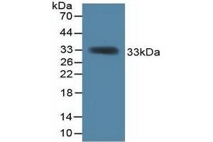 Detection of Recombinant KHDRBS1, Mouse using Polyclonal Antibody to KH Domain Containing, RNA Binding, Signal Transduction Associated Protein 1 (KHDRBS1) (KHDRBS1 Antikörper  (AA 156-381))
