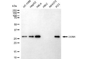 Western blotting analysis using DENR antibody (ABIN7798306). (Density Regulated Protein Antikörper)