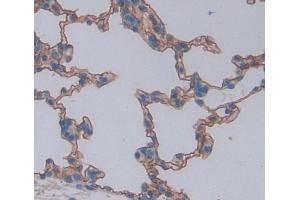Used in DAB staining on fromalin fixed paraffin- embedded lung tissue (ABCA8 Antikörper  (AA 1305-1516))