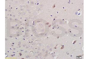 Formalin-fixed and paraffin embedded: rat brain tissue labeled with Anti-iNOS Polyclonal Antibody (ABIN725675) , Unconjugated at 1:200 followed by conjugation to the secondary antibody and DAB staining (NOS2 Antikörper)