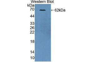 Figure. (CKAP2 Antikörper)