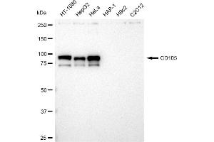 Western blotting analysis using CD105 antibody (ABIN7798440). (Rekombinanter Endoglin Antikörper)