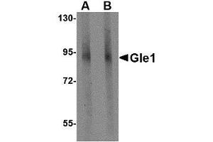 Western blot analysis of Gle1 in mouse brain tissue lysate with AP30366PU-N Gle1 antibody at (A) 1 and (B) 2 μg/ml. (GLE1 Antikörper  (C-Term))