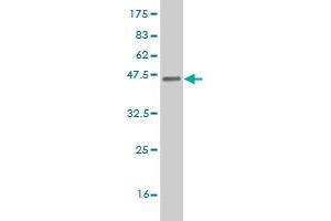 Western Blot detection against Immunogen (37. (ETV5 Antikörper  (AA 181-290))