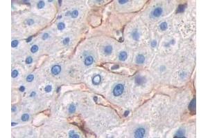 Immunohistochemistry (IHC) image for anti-C-Type Lectin Domain Family 4, Member M (CLEC4M) (AA 242-399) antibody (ABIN7441907)