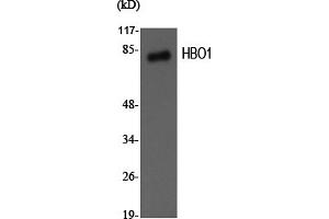Western Blotting (WB) image for anti-MYST Histone Acetyltransferase 2 (MYST2) antibody (ABIN5956839) (MYST2 Antikörper)