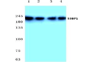 Western blot analysis of 53BP1 antibody at 1/500 dilution: Lane 1: Hela cell lysate. (TP53BP1 Antikörper)