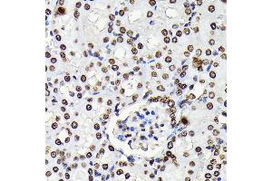 Immunohistochemistry of paraffin-embedded mouse kidney using Phospho-STA-Y694 antibody (ABIN6135328, ABIN6136272, ABIN6136273 and ABIN7101887) at dilution of 1:100 (40x lens). (STAT5A Antikörper  (pTyr694))