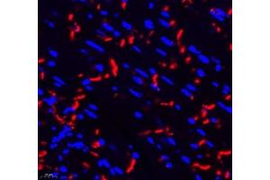 Immunofluorescence of paraffin embedded mouse heart using THNSL2 (ABIN7075893) at dilution of 1: 400 (400x lens) (THNSL2 Antikörper)