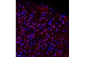 Immunofluorescence of paraffin embedded rat kidney using ZHX3 (ABIN7076287) at dilution of 1:650 (400x lens) (ZHX3 Antikörper)