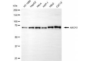 Western blotting analysis using ABCF2 antibody (ABIN7797690).
