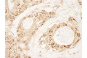 Immunohistochemistry (IHC) image for anti-Chromosome 1 Open Reading Frame 55 (C1orf55) (AA 350-400) antibody (ABIN7448452) (C1orf55 Antikörper  (AA 350-400))