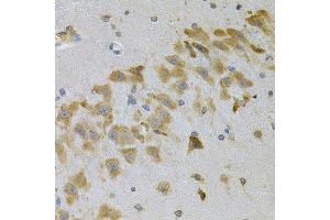 Immunohistochemistry (Paraffin-embedded Sections) (IHC (p)) image for anti-Insulin-Like Growth Factor Binding Protein 4 (IGFBP4) (AA 22-258) antibody (ABIN6142255)