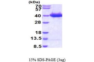 STK3 Protein (AA 1-322) (His tag)
